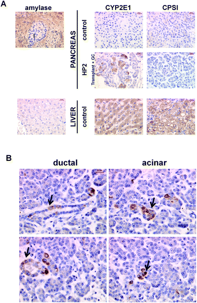 Immunohistochemical staining of human pancreas and liver sections. (A) Sections were stained for the exocrine pancreas marker amylase or liver markers CYP2E1 and CPS-I. Control pancreas was obtained from a patient with no record of extended systemic glucocorticoid therapy and no overt pancreatic abnormalities in H and E-stained sections. Two human pancreas samples from patients (HP1 and HP2) maintained on systemic glucocorticoid were available as archived paraffin blocks only. HP1 was a 65 year old male that had been maintained on prednisolone for 8 months for the treatment of pemphigoid. The patient underwent a pancreaticoduodenectomy for a pancreatic adenocarcinoma. HP2 was a 35 year old female recipient who received a simultaneous pancreas kidney transplant for end stage diabetic nephropathy. Her immunosuppressive regimen included prednisolone. Approximately 1 year after implantation the pancreas had to be removed because of sepsis and pancreas graft rejection/thrombosis. Liver sections were prepared from normal tissue at the margins of an hepatectomy for a secondary tumour. Mild steatosis observed is common. (B) Further high powered fields from HP2 immunostained for CYP2E1, demonstrating positive staining in both acinar and ductal cells. In general, positive cells were observed in acinar regions in occasionally in duct cells. Similar results were observed in sections from HP1, data not included.