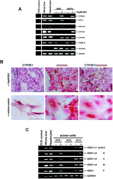 Human pancreatic acinar cells in culture express hepatocyte marker genes in response to treatment with glucocorticoid – trans-differentiation correlates with SGK1 v3 and F induction. Human pancreatic acinar cells were isolated as outlined in the methods section and where indicated, treated with 10 μM dexamethasone (DEX) or ethanol vehicle as control. After 14 days, cells were harvested and analyzed. (A) RT-PCR for the indicated transcript. PCR control, amplification in the absence of RNA in the 1st strand cDNA synthesis step. (B) Immunohistochemical staining for amylase and CYP2E1 in human acinar cells cultured in control medium or medium supplemented with 10 μM DEX for 14 days. Cells were fixed and co-stained amylase (brown) and CYP2E1 (blue) – data typical of staining from cells isolated from 5 individuals. C, RT-PCR for SGK1 variant transcript expression in human acinar cells treated for 14 days with (+) or without (−) 10 μM DEX for 14 days.