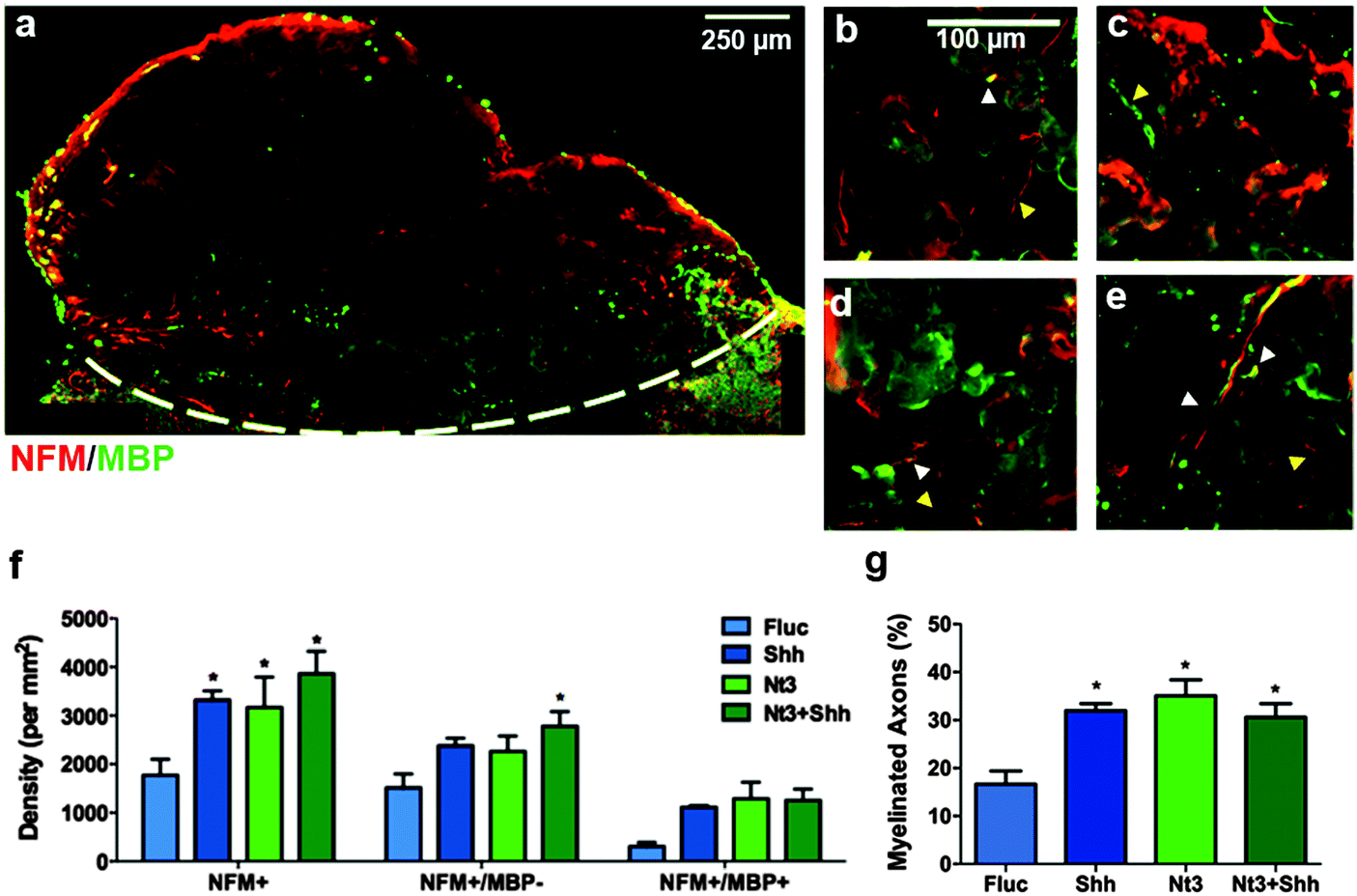 Sonic Hedgehog And Neurotrophin 3 Increase Oligodendrocyte Numbers