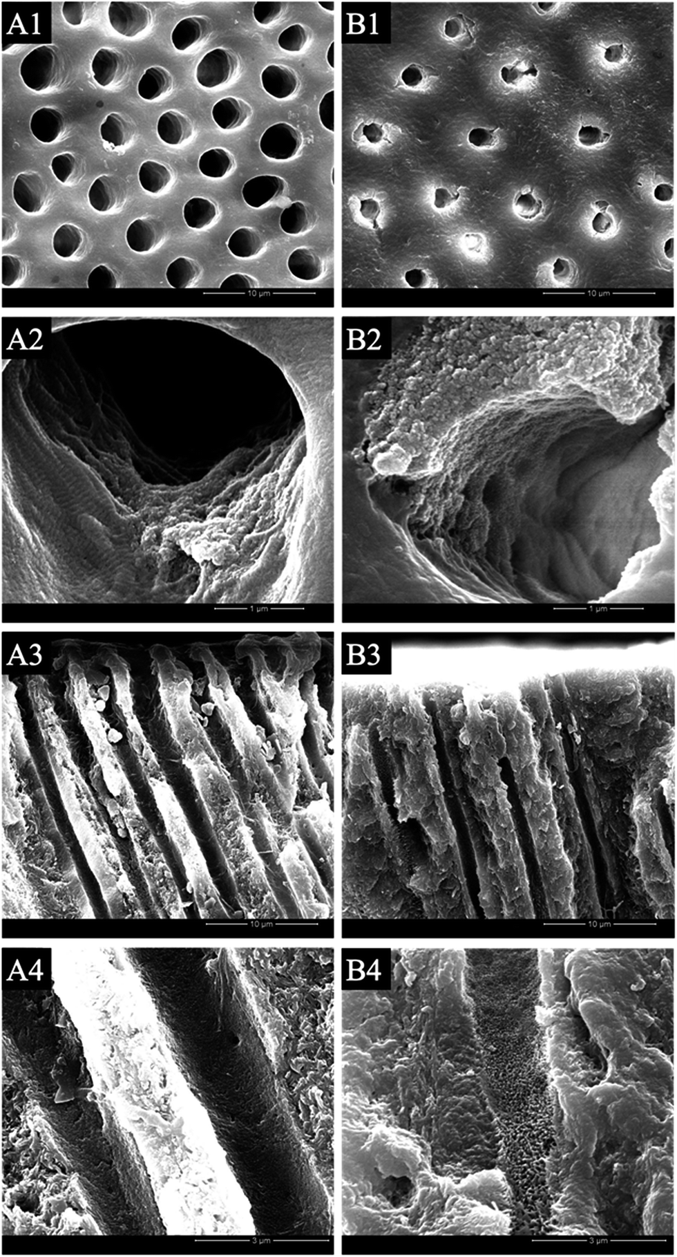 Effective dentinal tubule occlusion induced by polyhydroxy-terminated ...