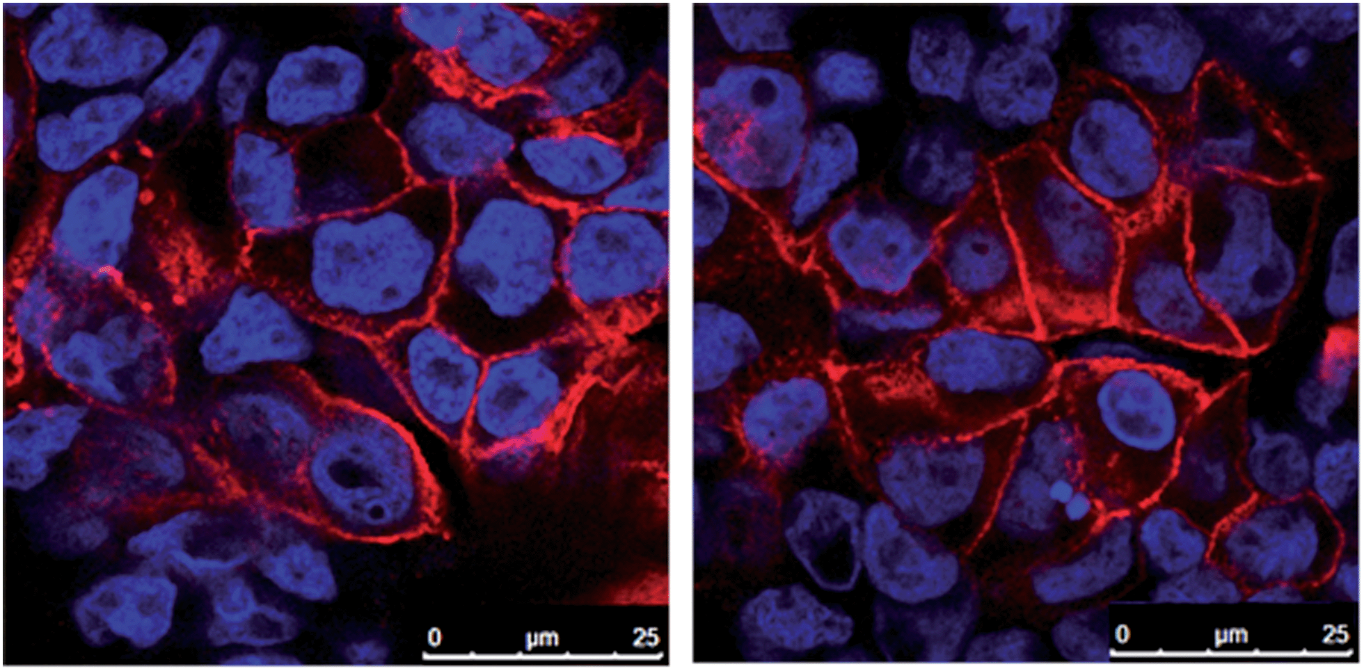 Клетки на второе. Caco-2 Cell. O2 клетки. Клеточная культура caco2. Confocal microscopy in vitro oocytes.