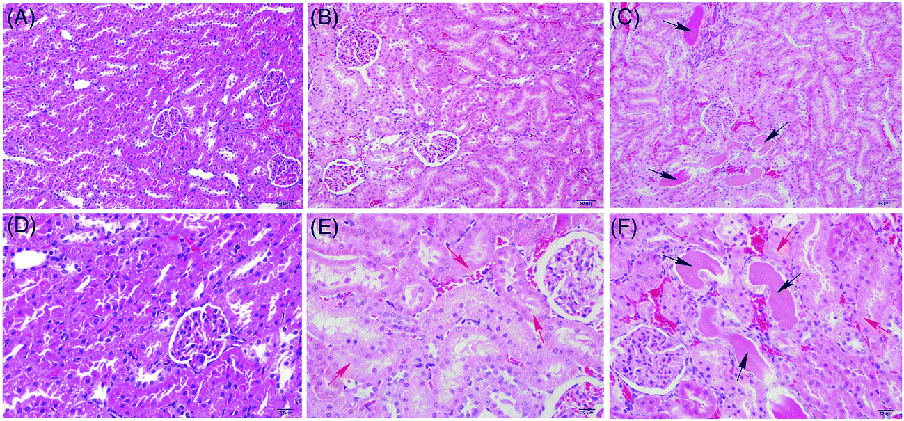 Chronic toxicity of crude ricinine in rats assessed by 1 H NMR 