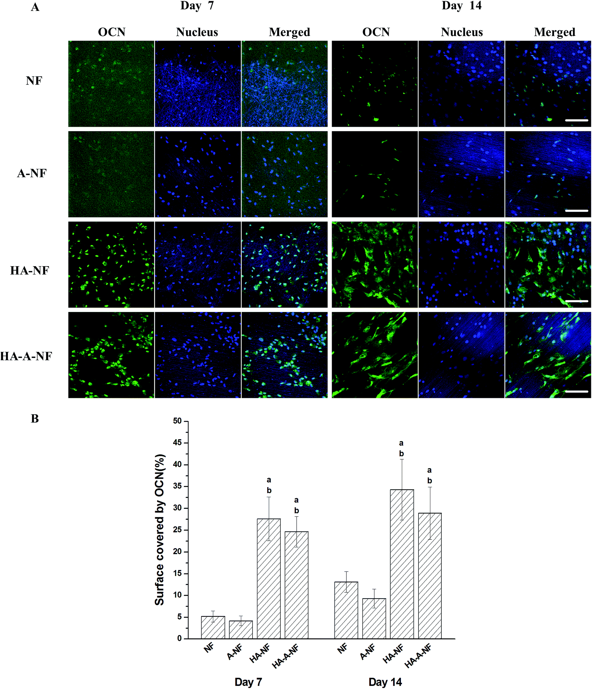 Spontaneous osteogenic differentiation of mesenchymal stem Spontaneous osteogenic differentiation of mesenchymal stem