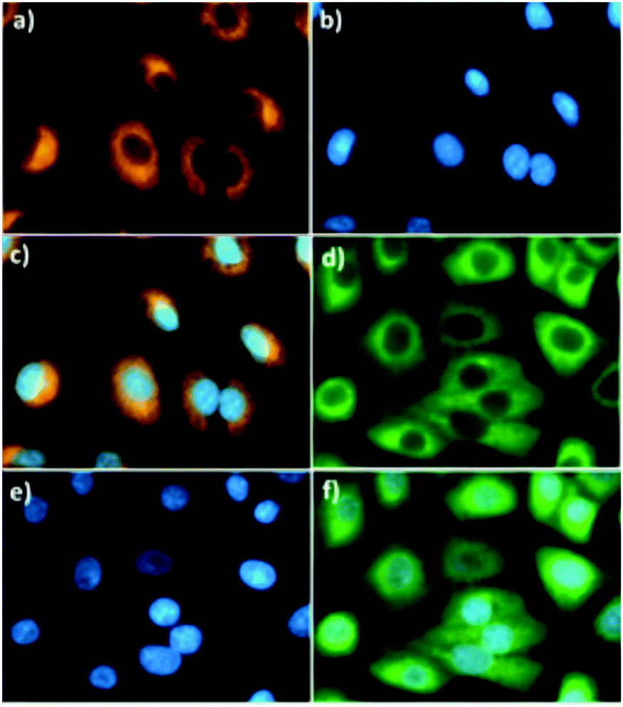 A Bodipy Based Fluorescent Probe For Ratiometric Detection Of Gold Ions Utilization Of Z Enynol