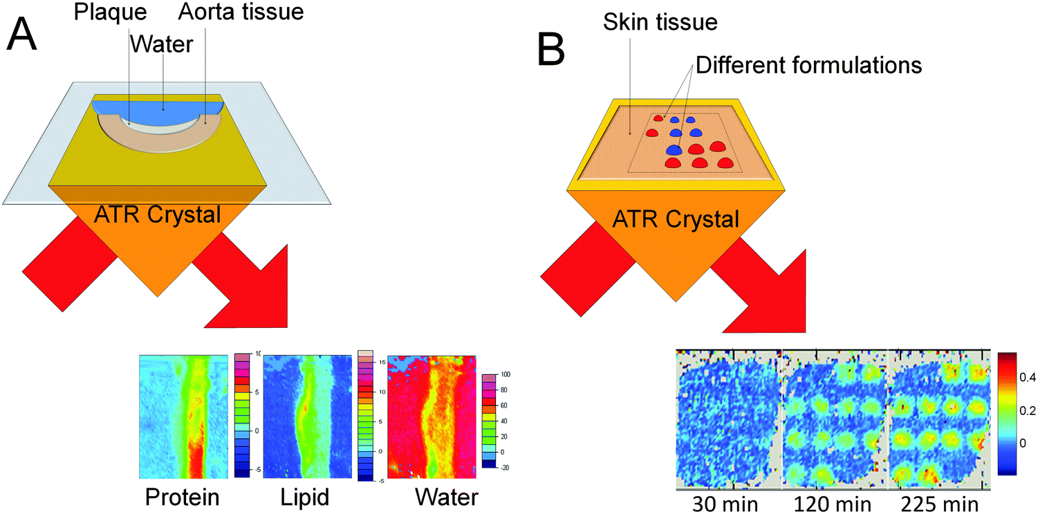 Attenuated Total Reflection Fourier Transform Infrared Atr Ftir Imaging Of Tissues And Live Cells Chemical Society Reviews Rsc Publishing