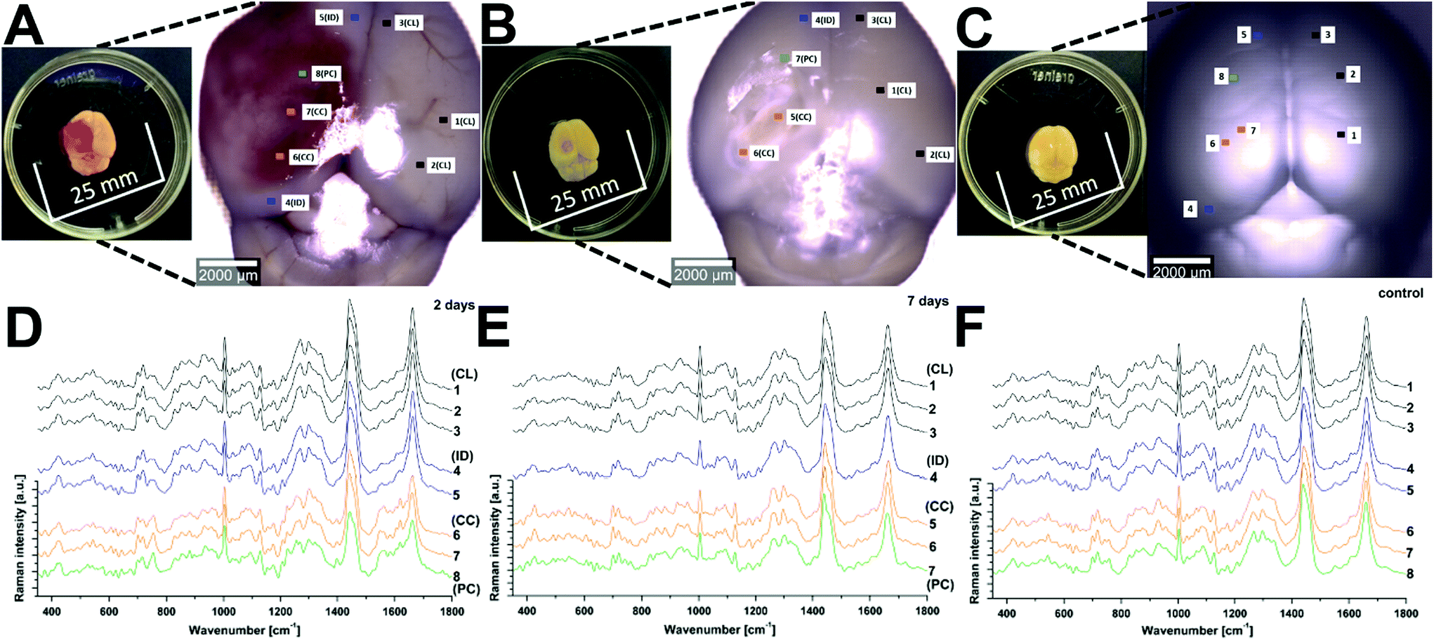 Labelfree monitoring of tissue biochemistry following traumatic brain