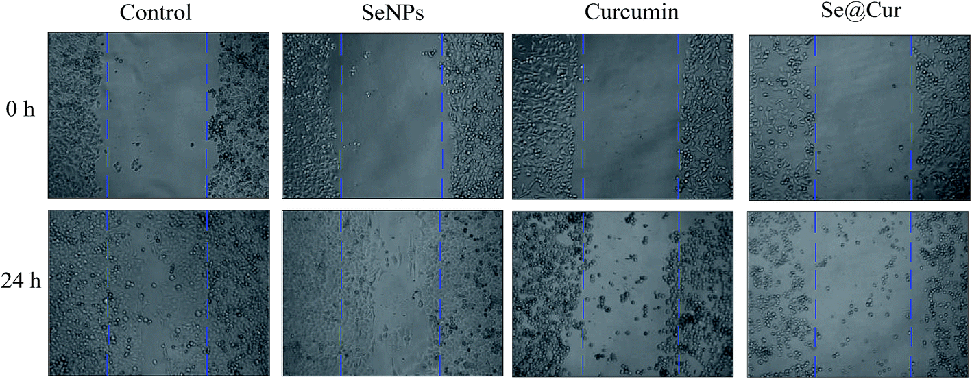 Surface decoration of selenium nanoparticles with curcumin induced ...