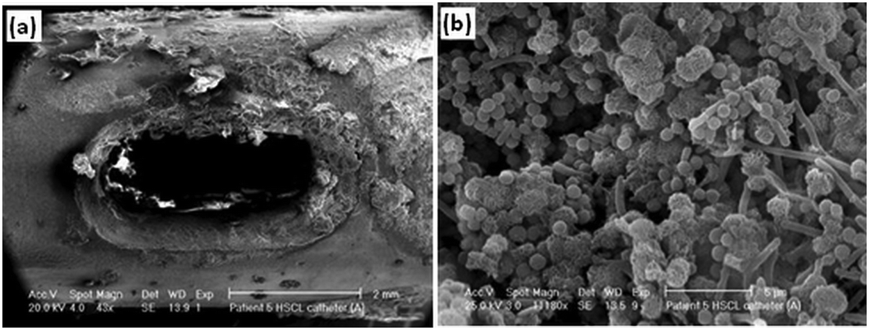 Surface modification strategies for combating catheter-related