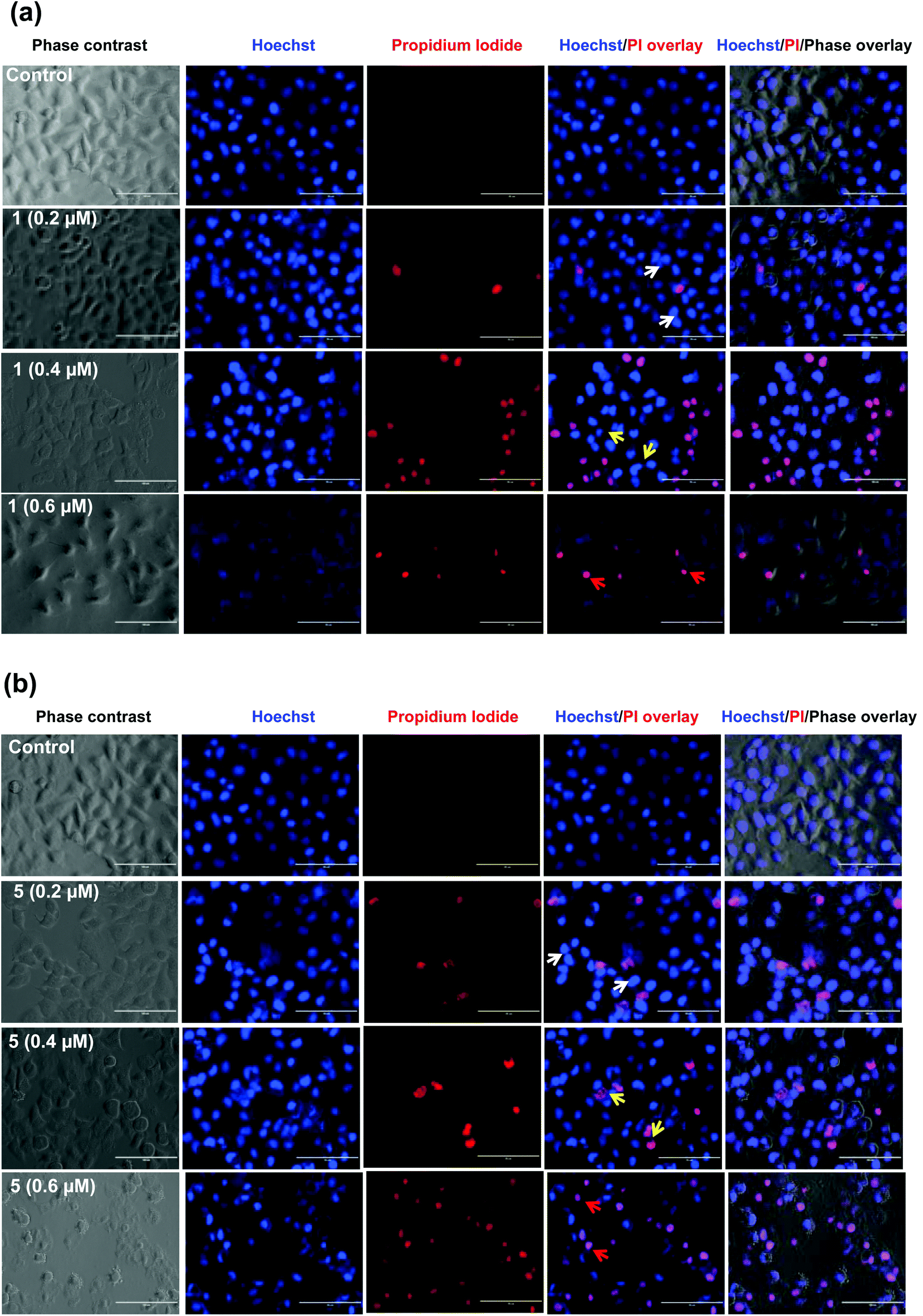 Enhanced in vitro therapeutic efficacy of triphenyltin (IV) loaded