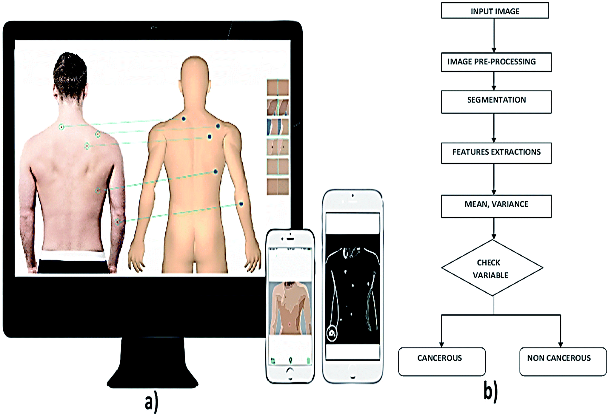Skin Cancer Detection  Vision and Image Processing Lab
