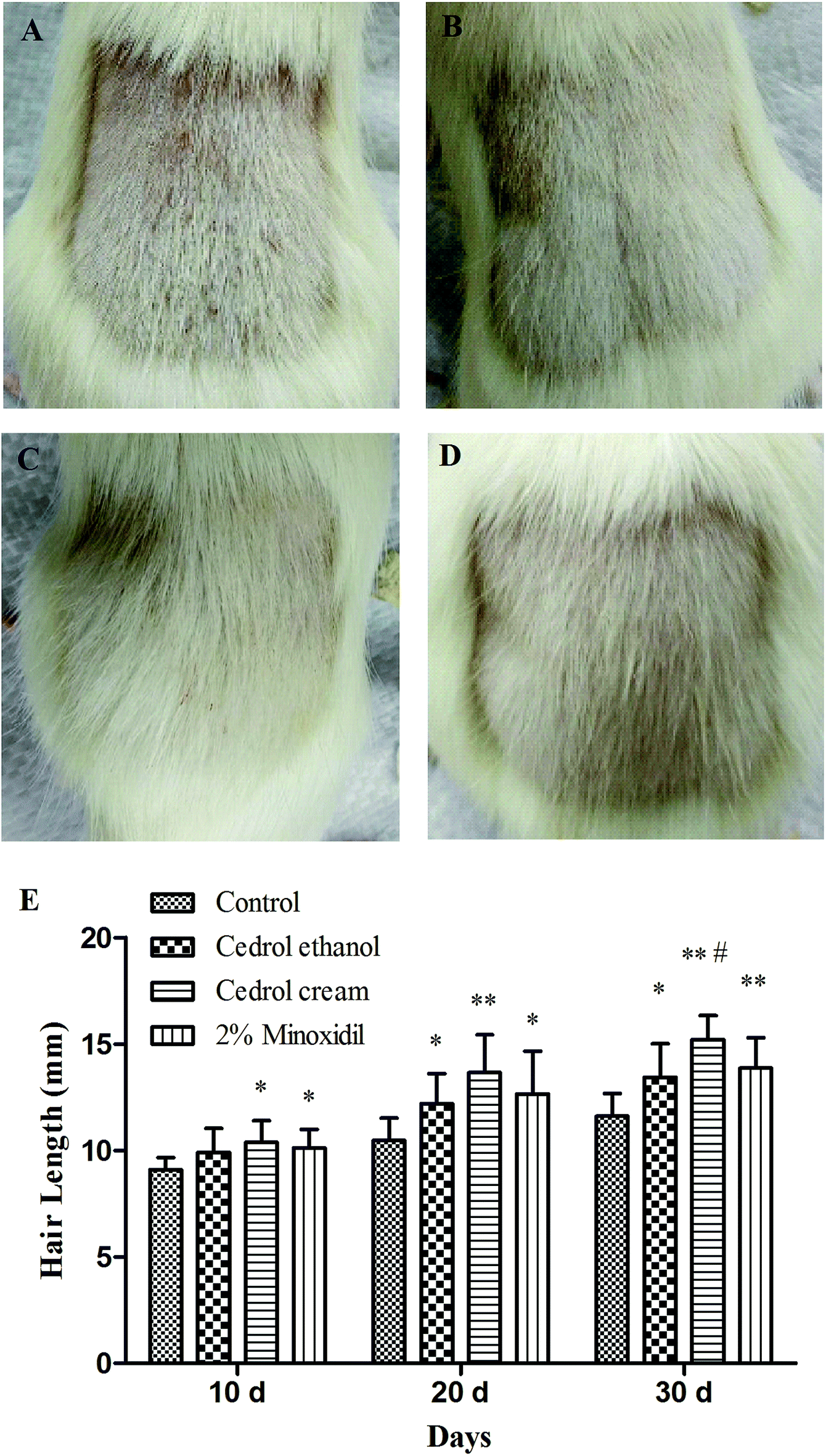 Hair growth promotion effect of cedrol cream and its  dermatopharmacokinetics - RSC Advances (RSC Publishing)  DOI:10.1039/C8RA08667B