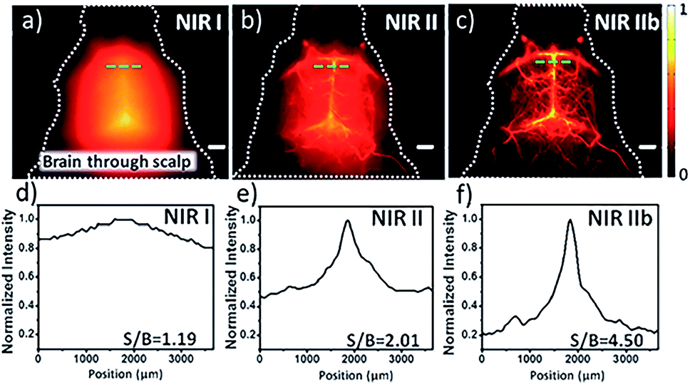 Recent advances in near-infrared II fluorophores for