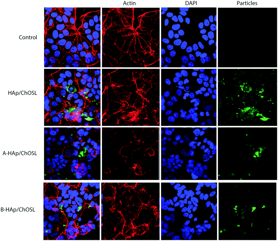 Chitosan Oligosaccharide Lactate Coated Hydroxyapatite Nanoparticles As A Vehicle For The Delivery Of Steroid Drugs And The Targeting Of Breast Cancer Journal Of Materials Chemistry B Rsc Publishing Doi 10 1039 C8tba