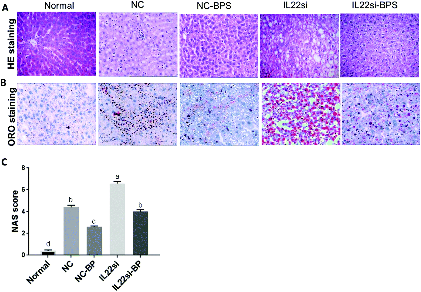 Blueberry, combined with probiotics, alleviates nonalcoholic fatty liver disease via IL22