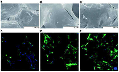 Local delivery of a novel PTHrP via mesoporous bioactive glass ...