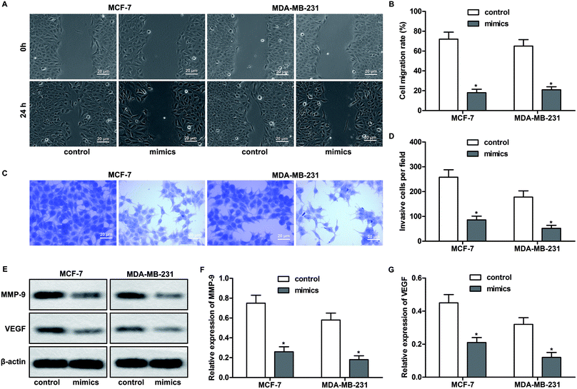 MiR-320d Suppresses The Progression Of Breast Cancer Via LncRNA HNF1A ...