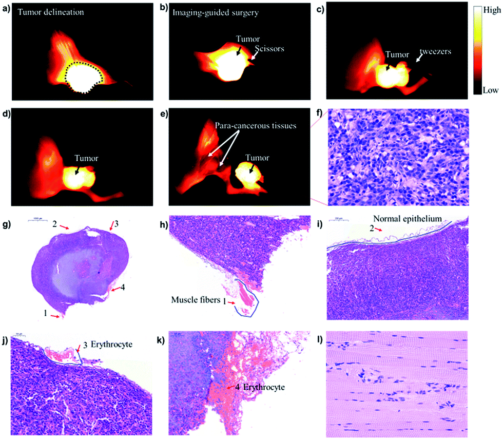 Novel Dual-function Near-infrared II Fluorescence And PET Probe For ...