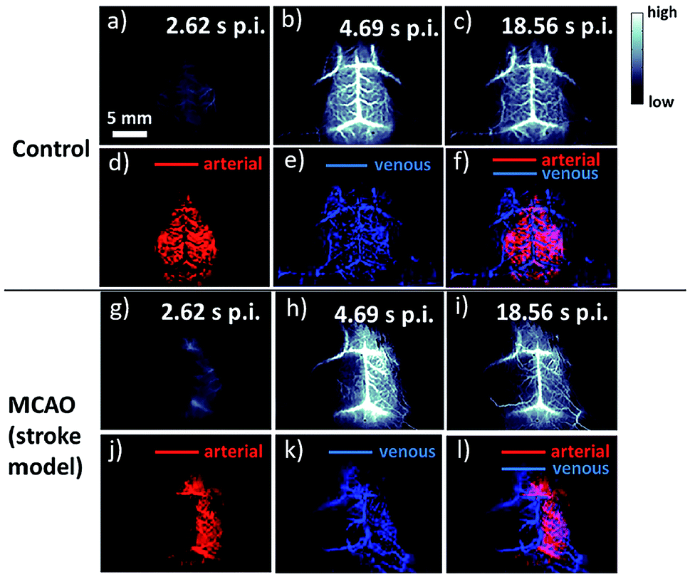 Recent Advances In Near-infrared II Fluorophores For Multifunctional ...