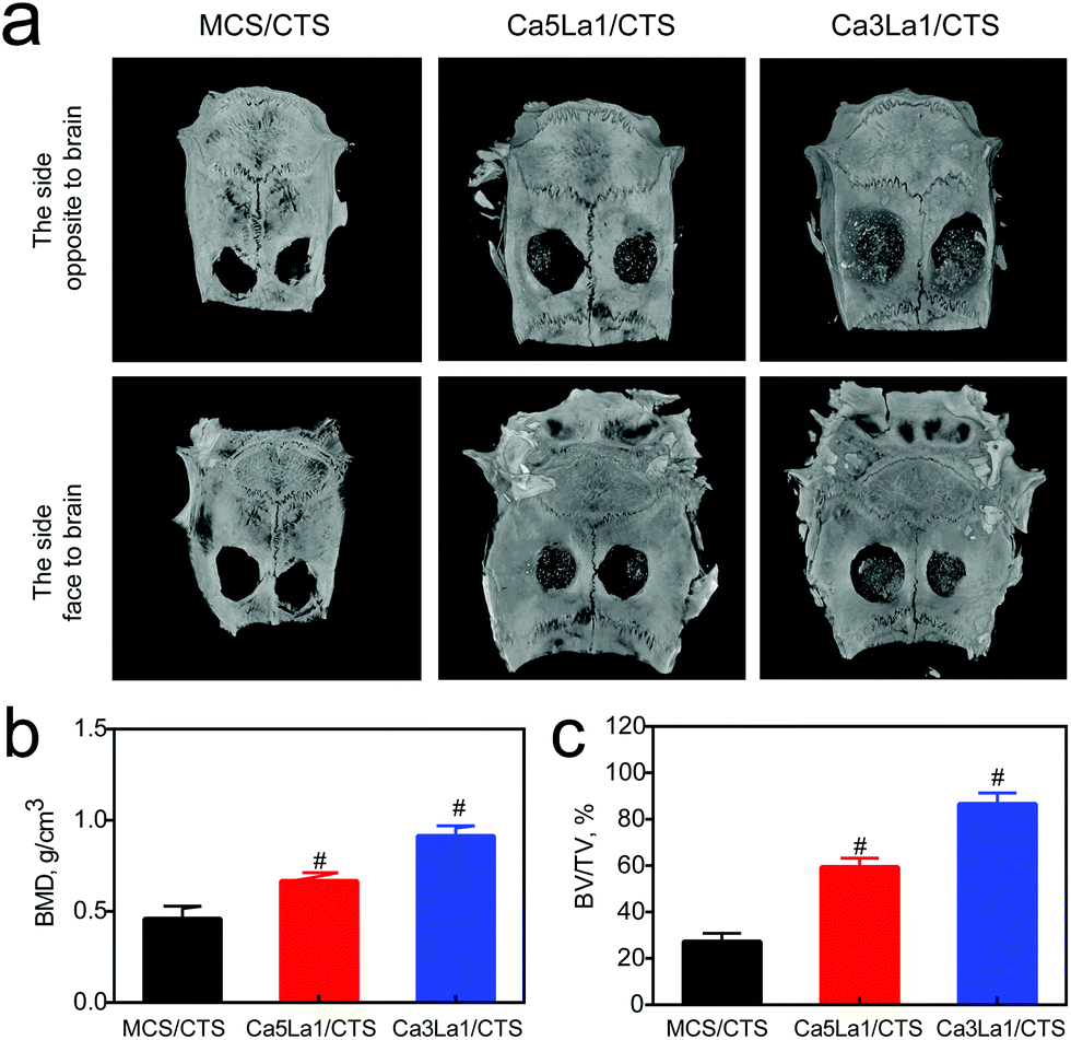 La Doped Mesoporous Calcium Silicate Chitosan Scaffolds For Bone Tissue Engineering Biomaterials Science Rsc Publishing Doi 10 1039 C8bma
