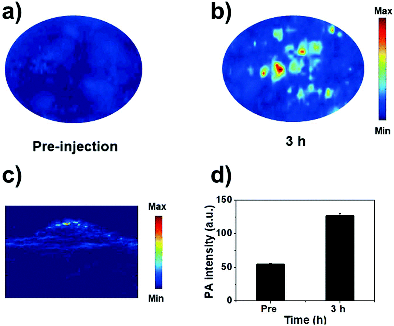 Novel Small Molecular Dye Loaded Lipid Nanoparticles With Efficient Near Infrared Ii Absorption For Photoacoustic Imaging And Photothermal Therapy Of Biomaterials Science Rsc Publishing Doi 10 1039 C9bme