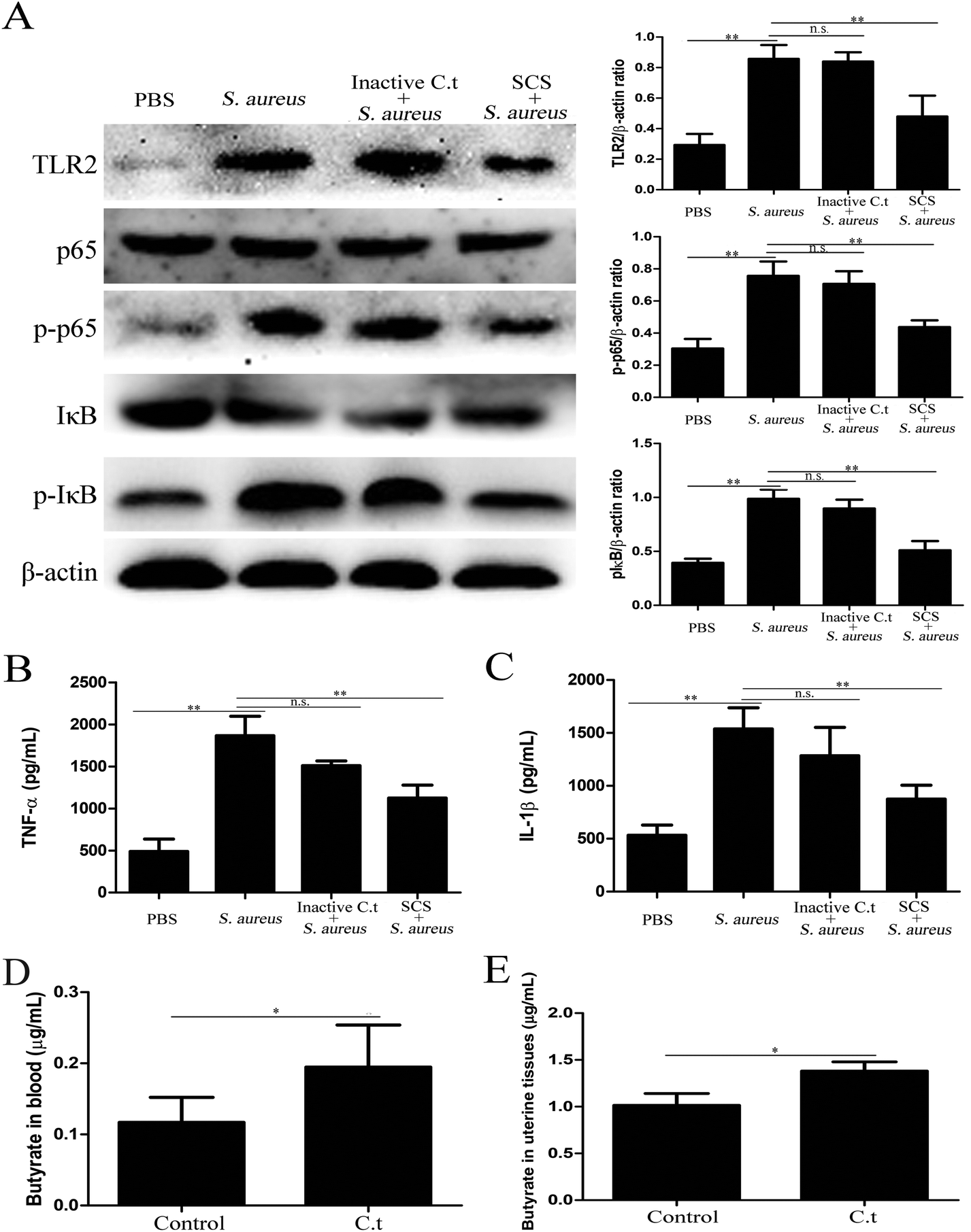 Clostridium tyrobutyricum alleviates Staphylococcus aureus