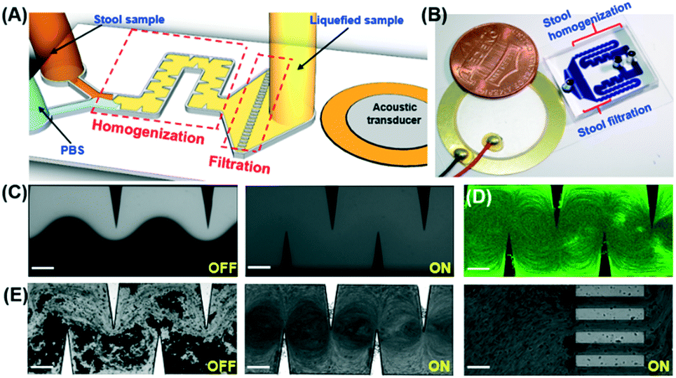 On-chip stool liquefaction via acoustofluidics - Lab on a Chip