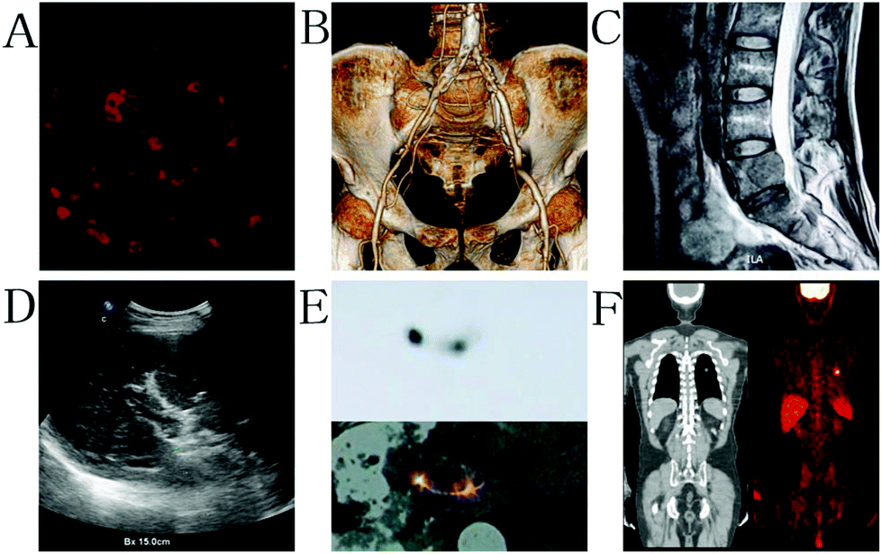 Various nanotechnology-based molecular imaging methods (A) PP/PS@MIONs