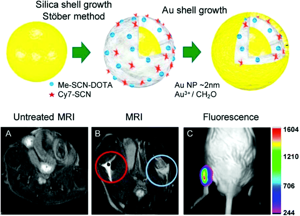 Various nanotechnology-based molecular imaging methods (A) PP/PS@MIONs