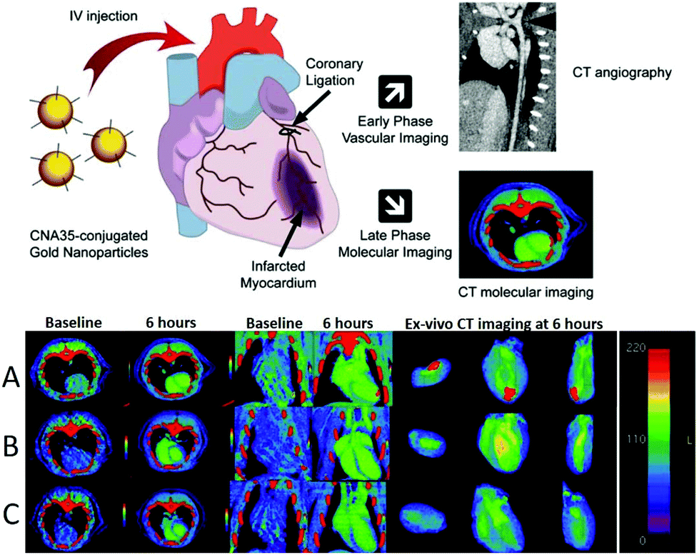 Various nanotechnology-based molecular imaging methods (A) PP/PS@MIONs