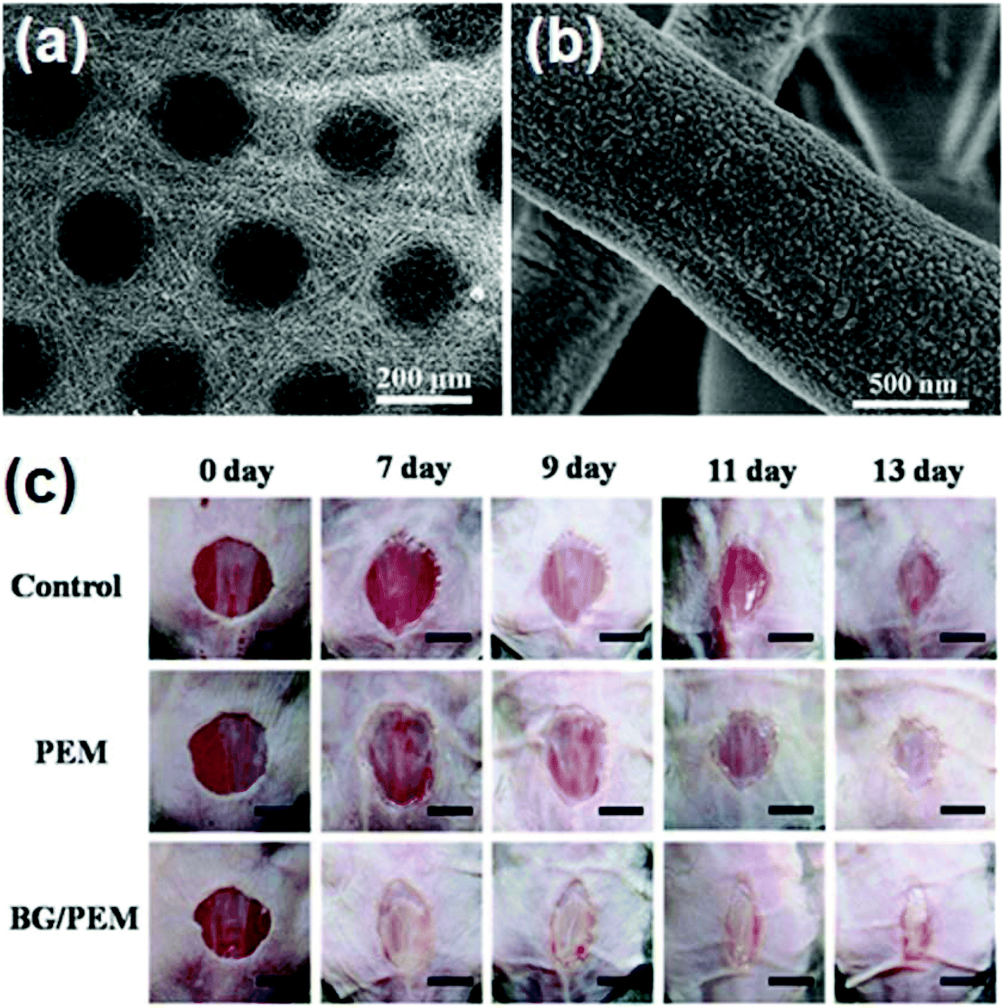 Nanobiomaterials: from 0D to 3D for tumor therapy and tissue