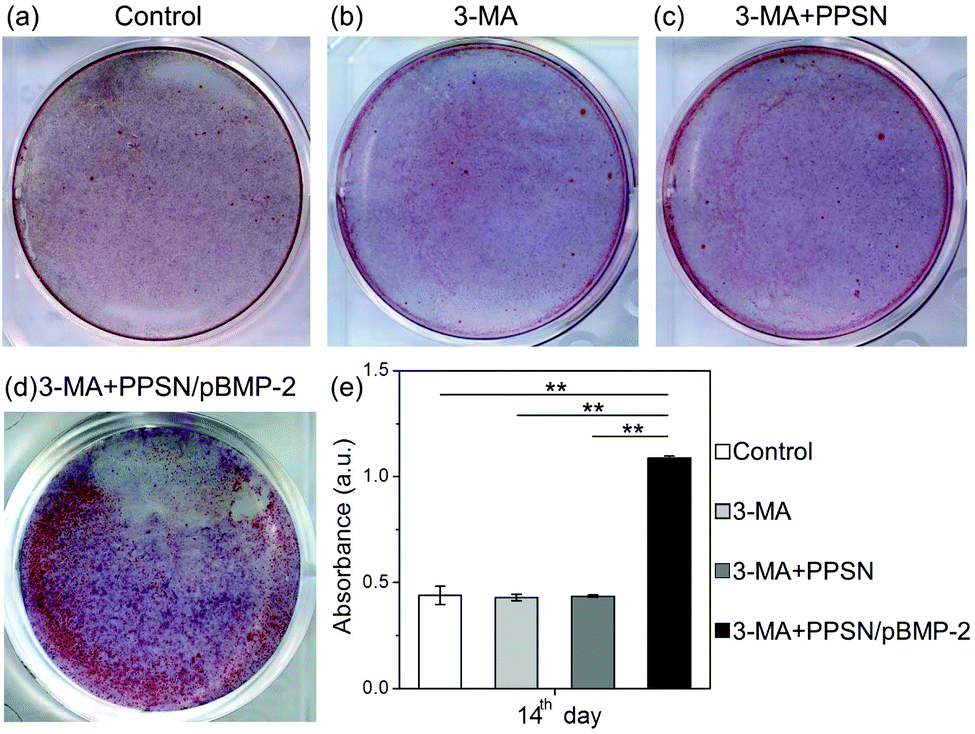 Bone Formation Promoted By Bone Morphogenetic Protein 2 Plasmid Loaded Porous Silica Nanoparticles With The Involvement Of Autophagy Nanoscale Rsc Publishing Doi 10 1039 C9nrf Bone Formation Promoted By Bone Morphogenetic Protein 2 Plasmid Loaded Porous Silica Nanoparticles With The Involvement Of Autophagy Nanoscale Rsc Publishing Doi 10 1039 C9nrf