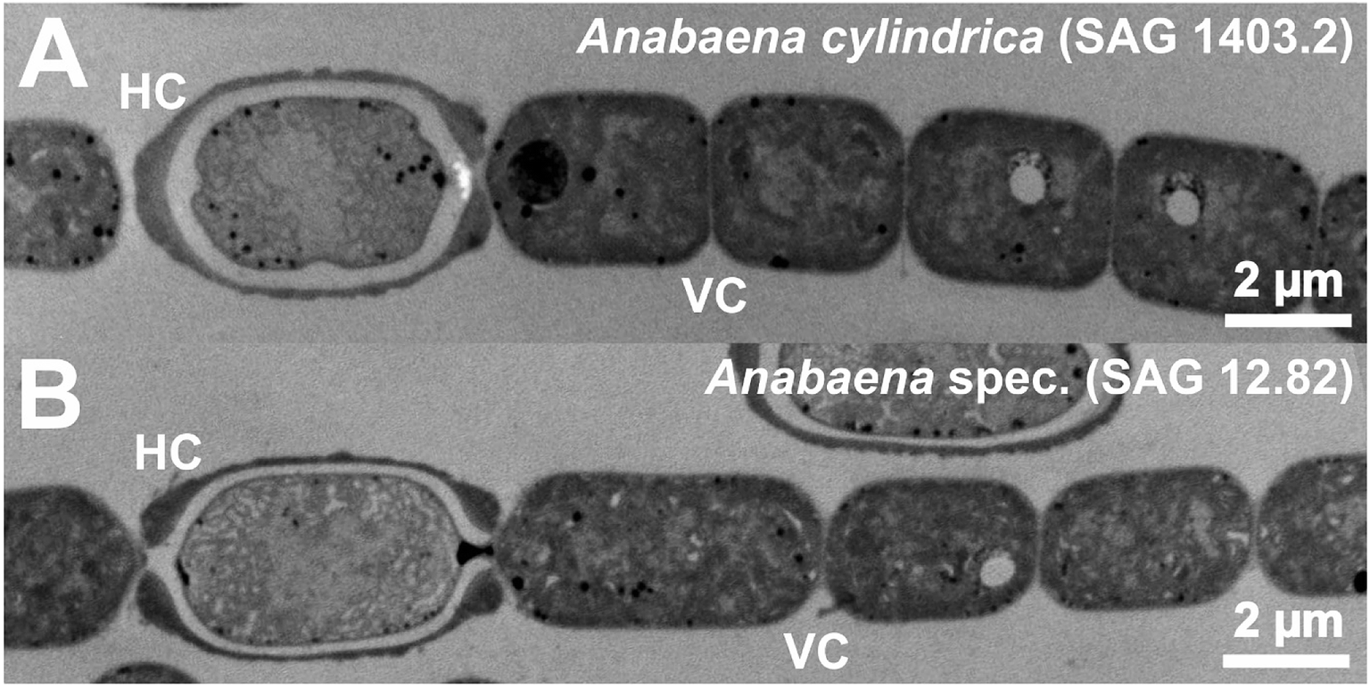 anabaena heterocysts gram stain