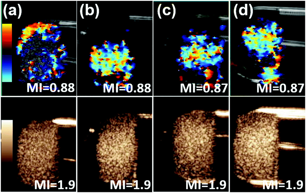 Tuning The Ultrasonic And Photoacoustic Response Of Polydopamine Stabilized Perfluorocarbon Contrast Agents Journal Of Materials Chemistry B Rsc Publishing Doi 10 1039 C9tbk