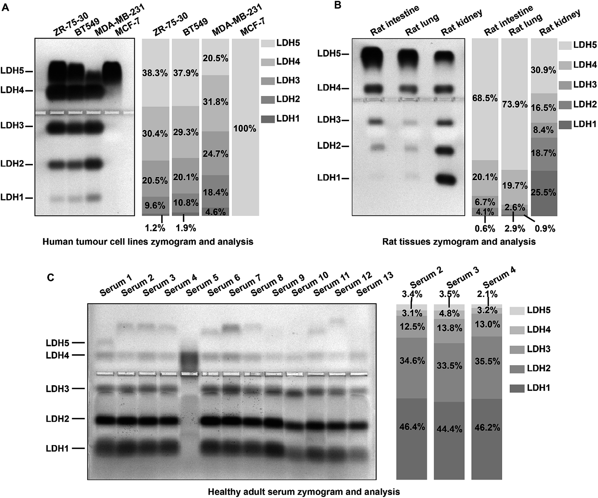 A More Universal And Stable Method For Lactate Dehydrogenase Isoenzyme Test Analytical Methods Rsc Publishing