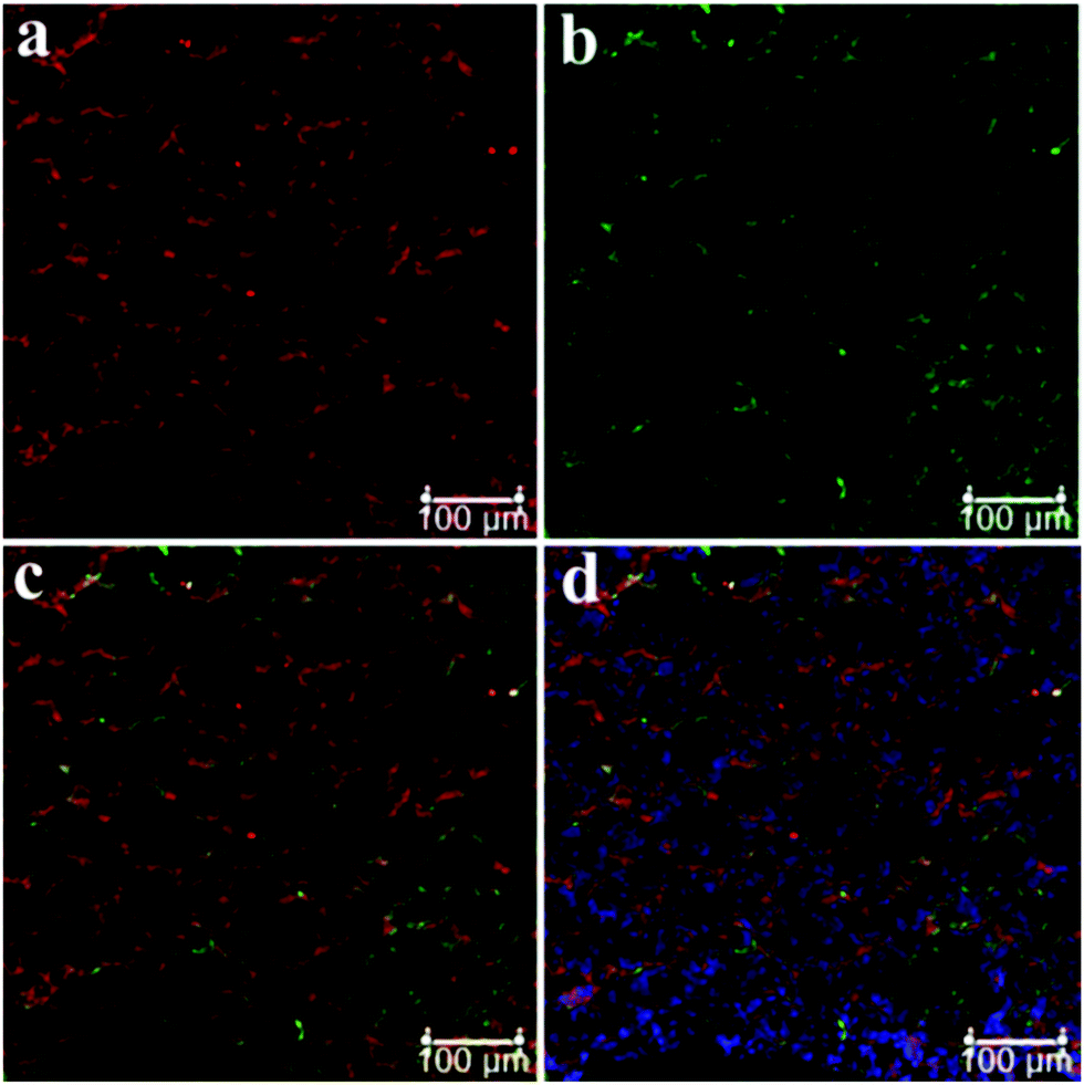 NAGtargeting fluorescence based probe for precision diagnosis of