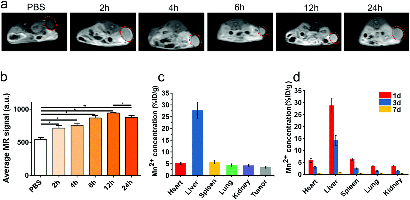 A Combination Of Glioma In Vivo Imaging And In Vivo Drug Delivery By Metal Organic Framework Based Composite Nanoparticles Journal Of Materials Chemistry B Rsc Publishing