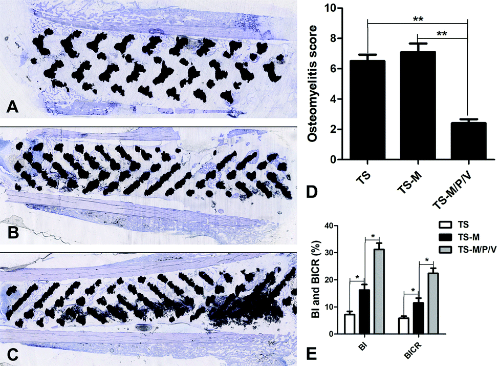 Sustainable release of vancomycin from micro-arc oxidised 3D-printed porous  Ti6Al4V for treating methicillin-resistant Staphylococcus aureus bone infe  ... - Biomaterials Science (RSC Publishing) DOI:10.1039/C9BM01968E