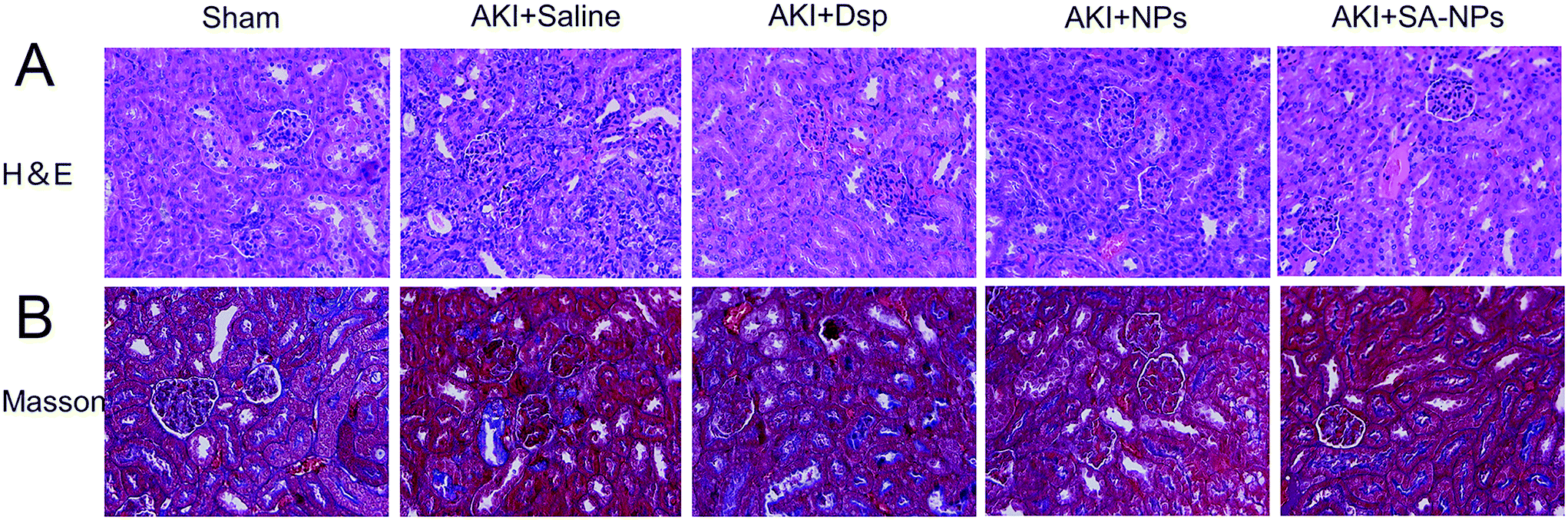 Sialic acid-modified dexamethasone lipid calcium phosphate Sialic acid-modified dexamethasone lipid calcium phosphate