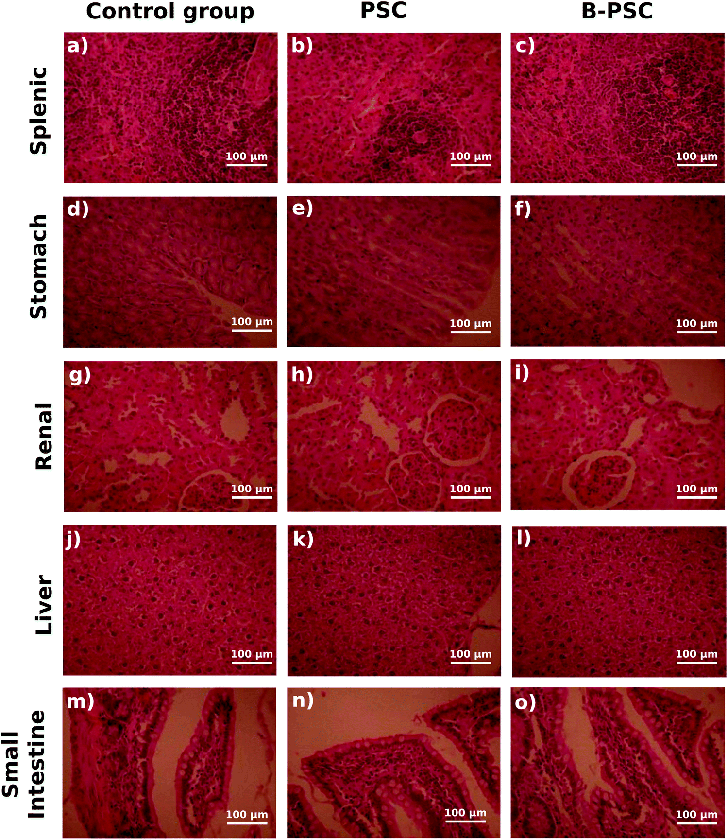 Masses of different root fractions of Araucaria angustifolia at the end