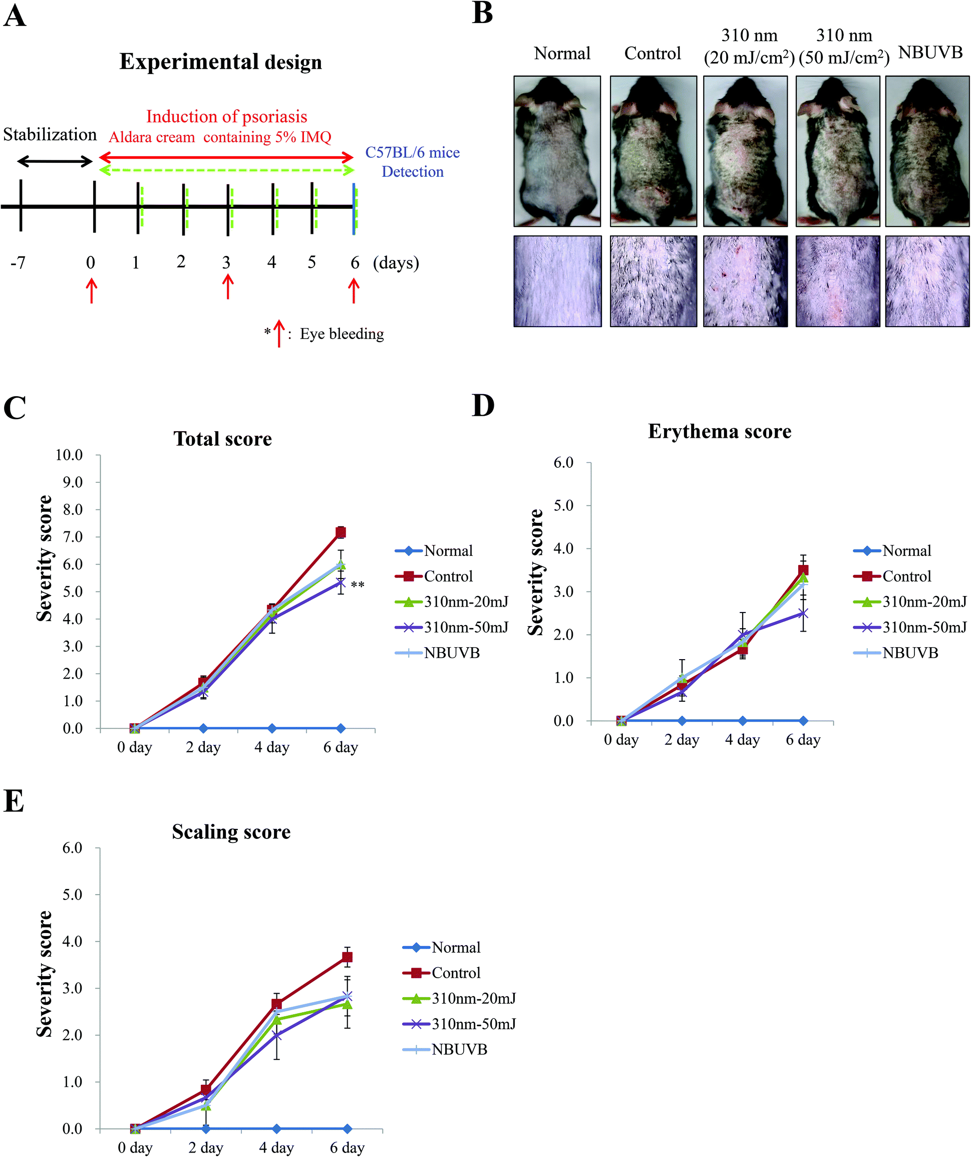 310 Nm Uv Leds Attenuate Imiquimod Induced Psoriasis Like Skin Lesions In C57bl 6 Mice And Inhibit Il 22 Induced Stat3 Expression In Hacat Cells Photochemical Photobiological Sciences Rsc Publishing Doi 10 1039 C9ppk