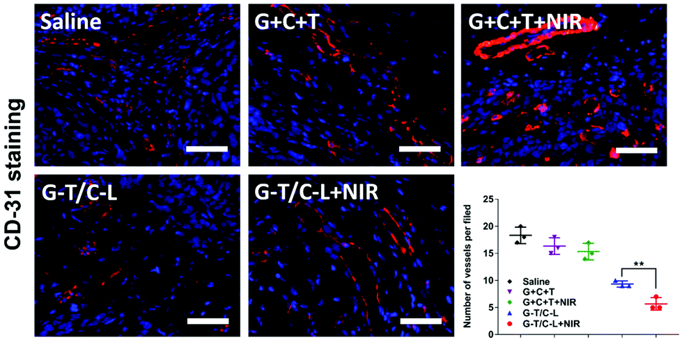 Mild Heat Inducible Sequentially Released Liposomal Complex Remodels The Tumor Microenvironment And Reinforces Anti Breast Cancer Therapy Biomaterials Science Rsc Publishing