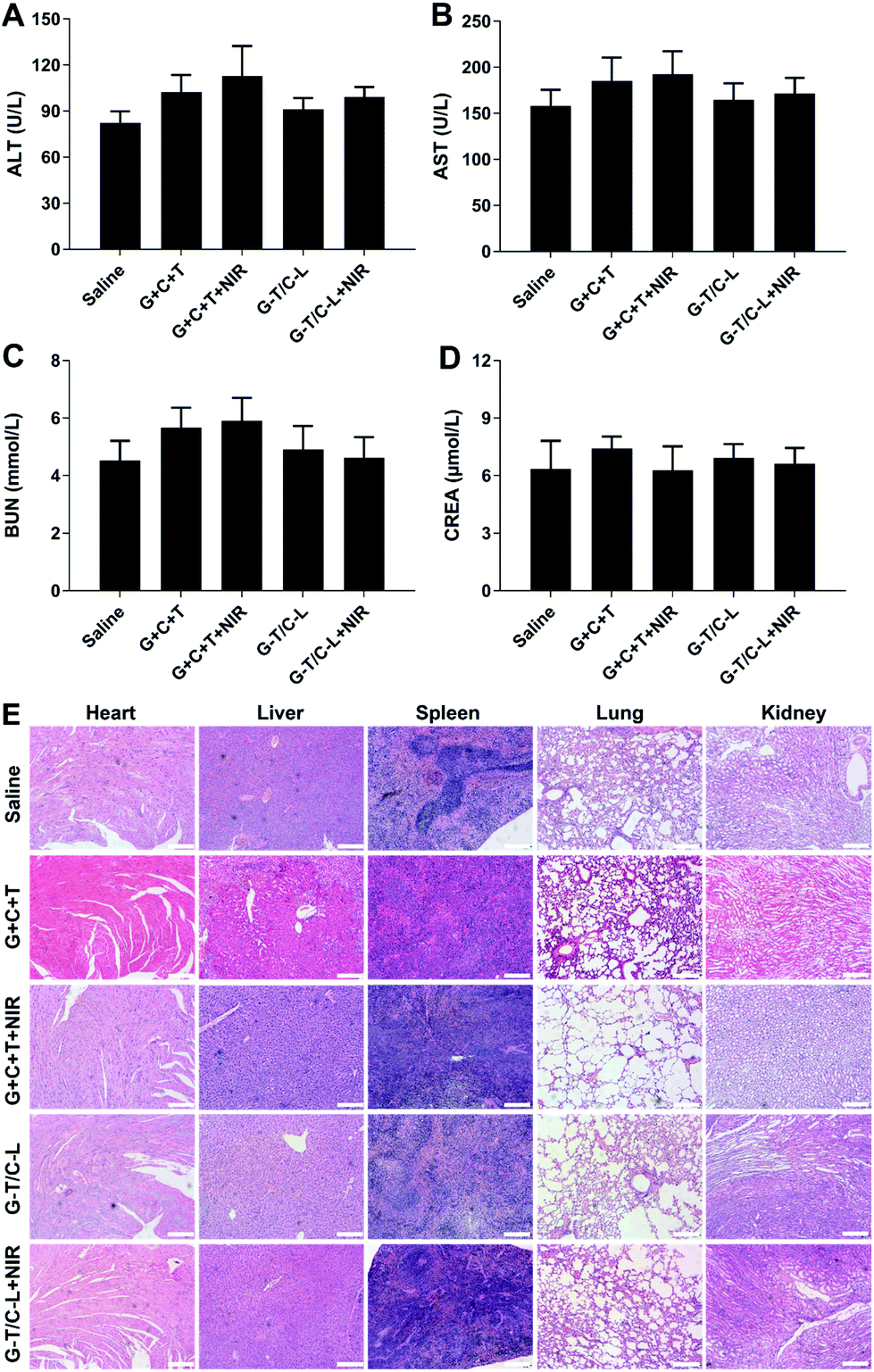 Mild Heat Inducible Sequentially Released Liposomal Complex Remodels The Tumor Microenvironment And Reinforces Anti Breast Cancer Therapy Biomaterials Science Rsc Publishing