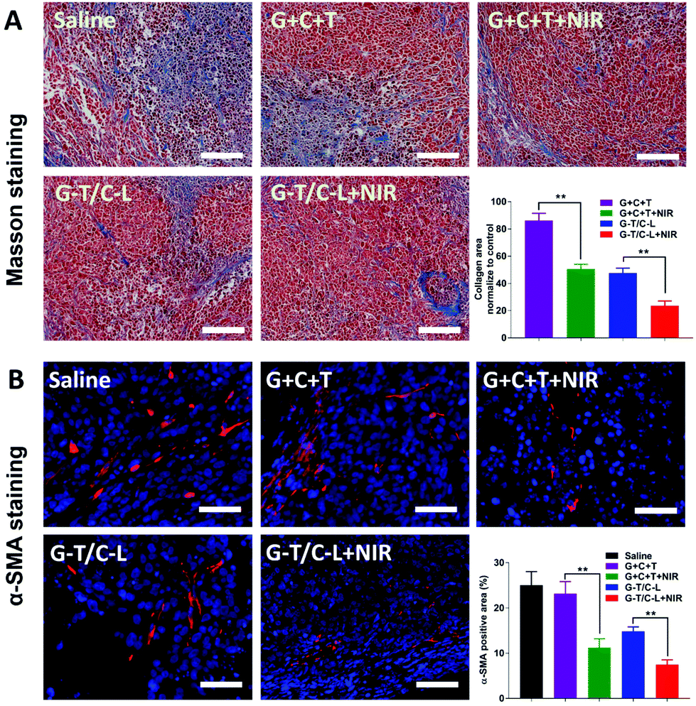 Mild Heat Inducible Sequentially Released Liposomal Complex Remodels The Tumor Microenvironment And Reinforces Anti Breast Cancer Therapy Biomaterials Science Rsc Publishing