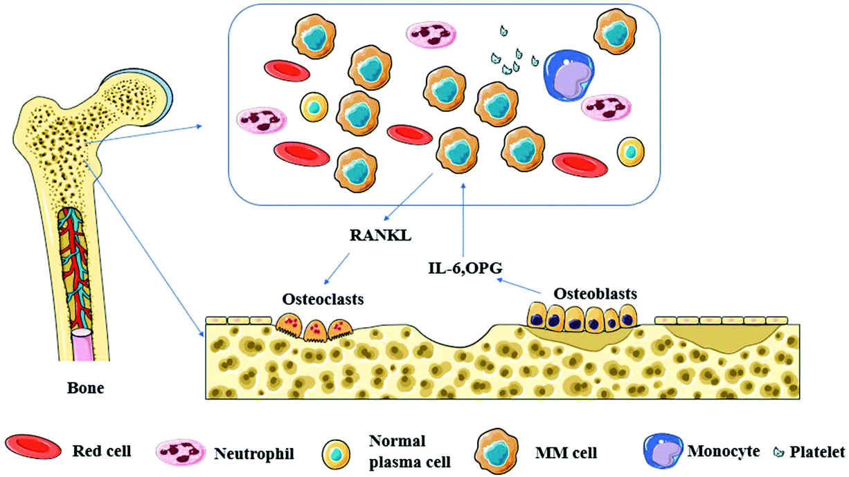 Advancements In Nanotechnology For The Diagnosis And Treatment Of Multiple Myeloma Biomaterials Science Rsc Publishing