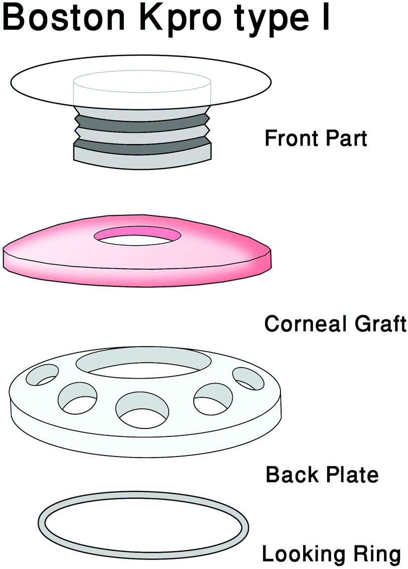 The Progress In Corneal Translational Medicine Biomaterials Science Rsc Publishing