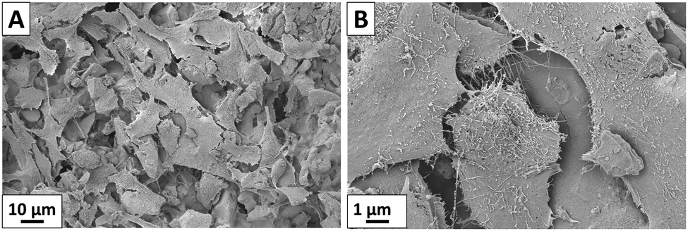 Ag and Mn-doped mesoporous bioactive glass nanoparticles incorporated ...