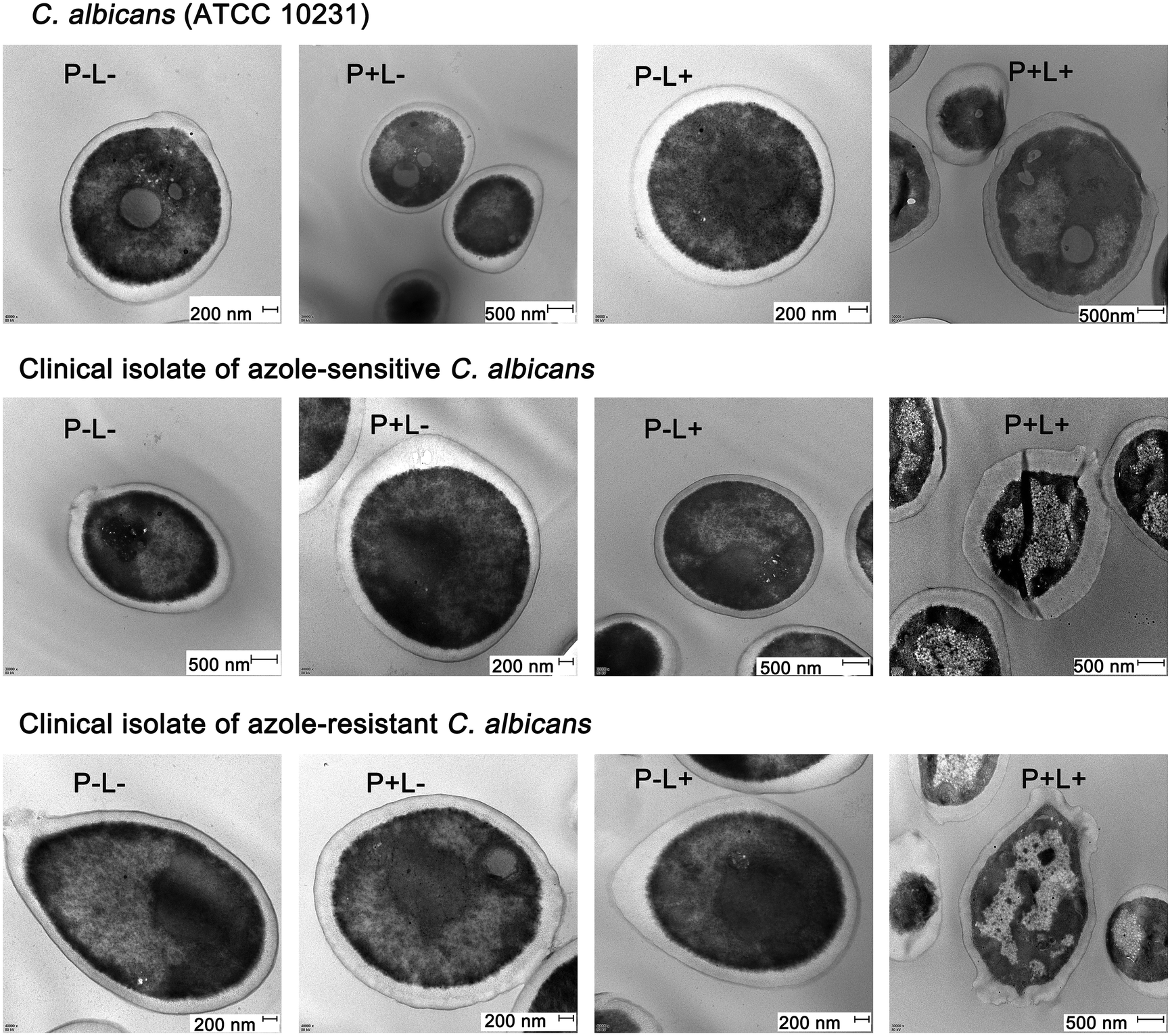 The Effects Of Aloe Emodin Mediated Antimicrobial Photodynamic Therapy On Drug Sensitive And Resistant Candida Albicans Photochemical Photobiological Sciences Rsc Publishing