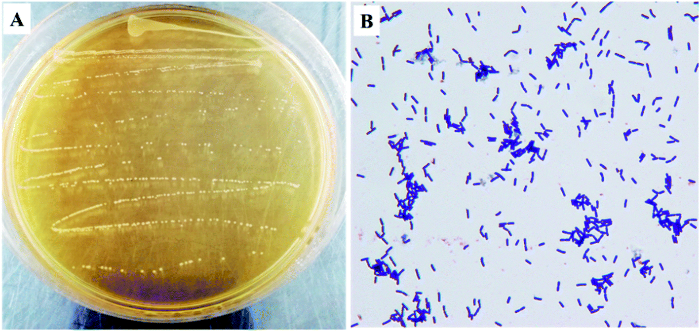 Lactobacillus Plantarum Colony Morphology 7740