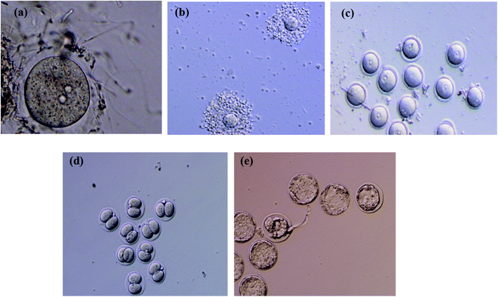 Enhanced delivery of melatonin loaded nanostructured lipid carriers ...