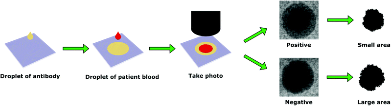 File:Blood typing by gel card method (column agglutination or MTS